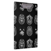 脳MRIスキャン クリップボード (右)