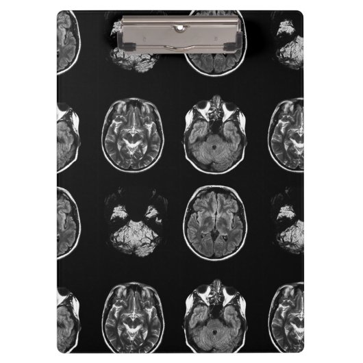脳MRIスキャン クリップボード (正面)