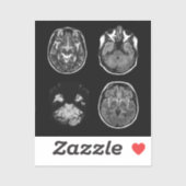 脳MRIスキャン シール (シート)