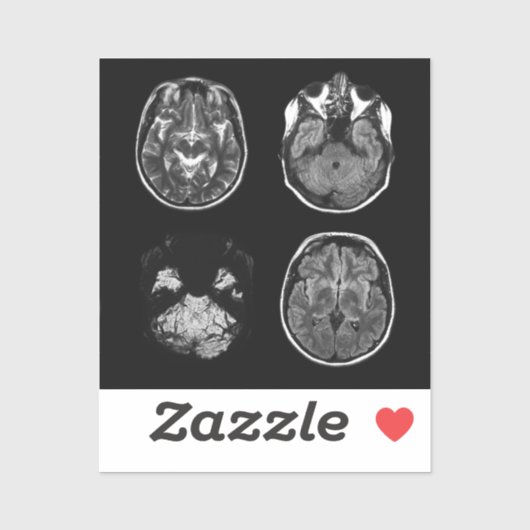 脳MRIスキャン シール (シート)