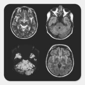 脳MRIスキャン スクエアシール (正面)