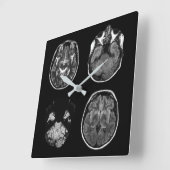 脳MRIスキャン スクエア壁時計 (傾斜)