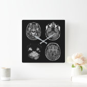 脳MRIスキャン スクエア壁時計 (ホーム)