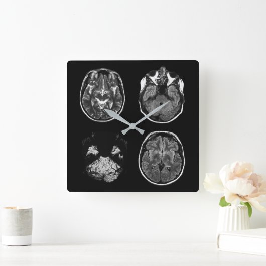 脳MRIスキャン スクエア壁時計 (ホーム)