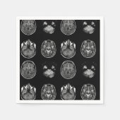 脳MRIスキャン スタンダードカクテルナプキン (正面)