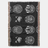 脳MRIスキャン スローブランケット (正面縦)