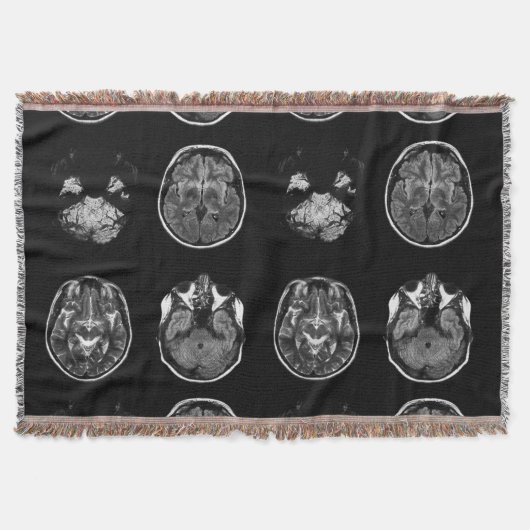 脳MRIスキャン スローブランケット (正面)