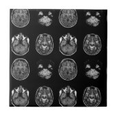 脳MRIスキャン タイル (正面)