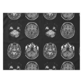 脳MRIスキャン テーブルクロス (正面(横))