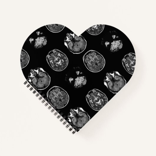 脳MRIスキャン ノートブック (正面)