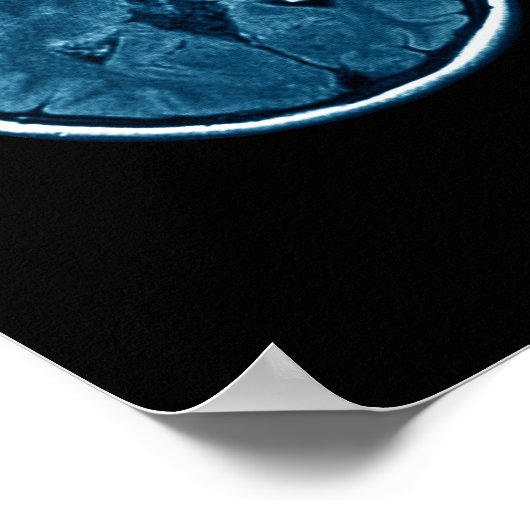 脳Mriスキャン ポスター (角)