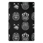 脳MRIスキャン ミニクリップボード (裏面)