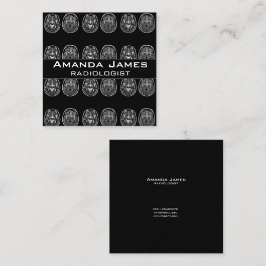 脳MRIスキャン 予約カード (正面/裏面)