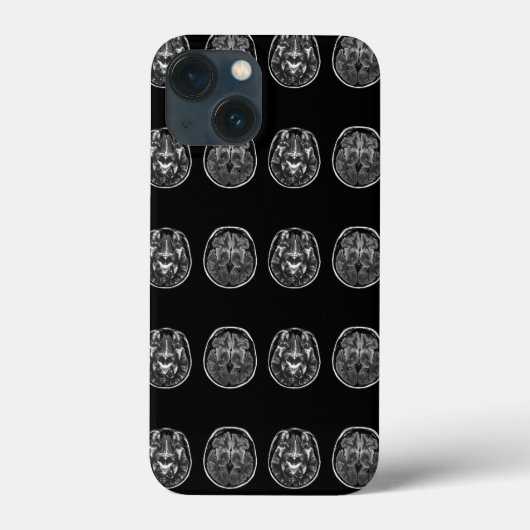 脳MRIスキャン Case-Mate iPhoneケース (裏面)