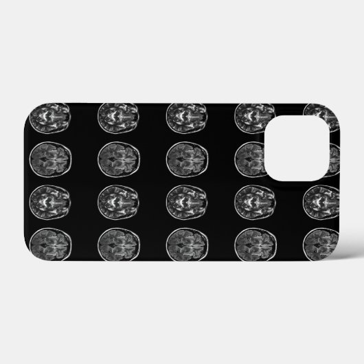 脳MRIスキャン Case-Mate iPhoneケース (裏面 (横))