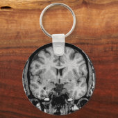 脳MRI、コロナ・スライス キーホルダー (正面)