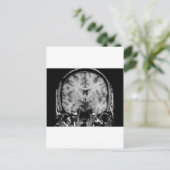 脳MRI、コロナ・スライス ポストカード (スタンド正面)