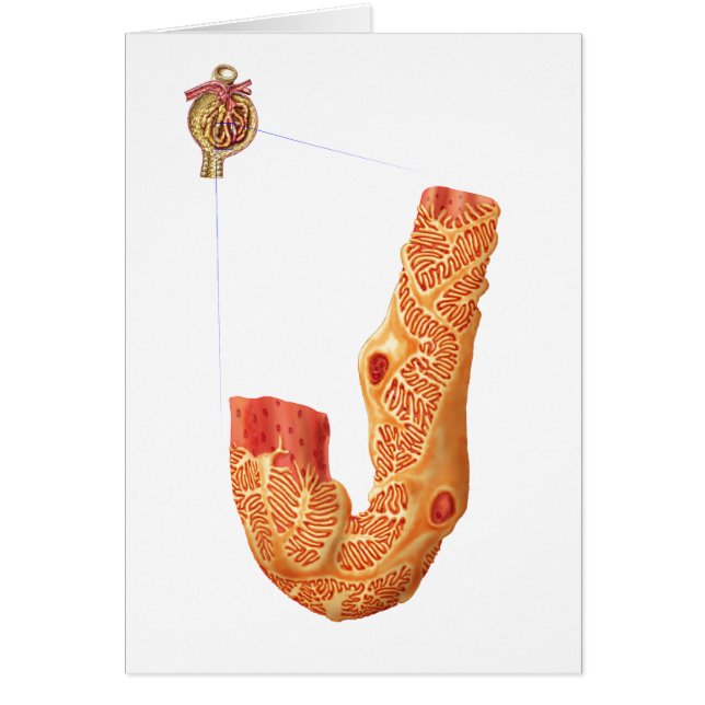 腎小体およびろ過膜 (正面)