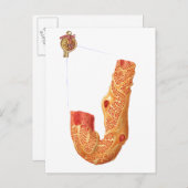 腎小体およびろ過膜 ポストカード (正面/裏面)