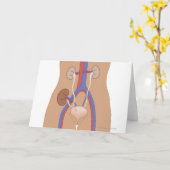 腎移植 カード (黄色い花)