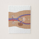 腎移植 ジグソーパズル (縦)