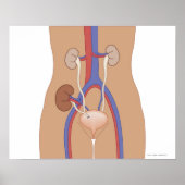 腎移植 ポスター (正面)