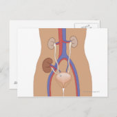 腎移植 ポストカード (正面/裏面)