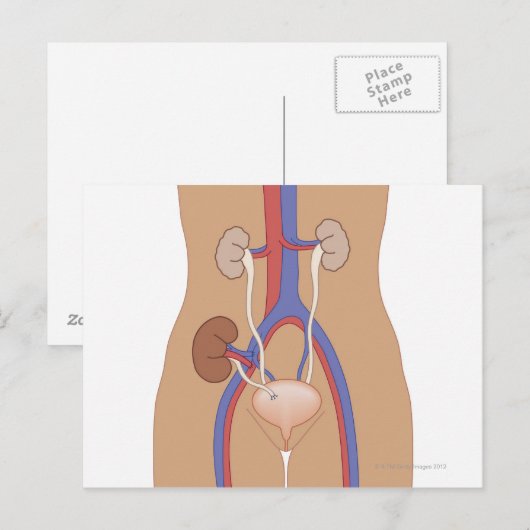 腎移植 ポストカード (正面/裏面)