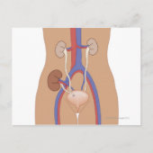 腎移植 ポストカード (正面)