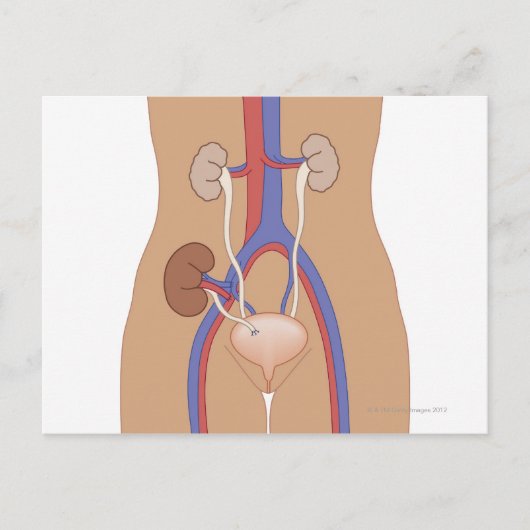 腎移植 ポストカード (正面)