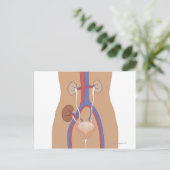 腎移植 ポストカード (スタンド正面)