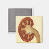 腎結石 マグネット (正面/裏面)