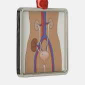 腎臓の移植 メタルオーナメント (右)