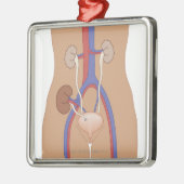 腎臓の移植 メタルオーナメント (左)