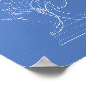 腎臓学バスト1856年の特許アート青写真 ポスター (角)