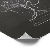 腎臓学バスト1856特許技術シャルボード ポスター (角)