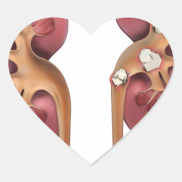 腎臓 ハートシール