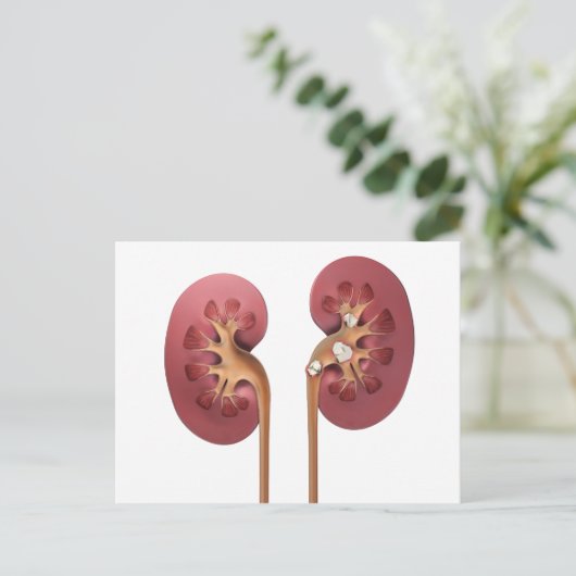 腎臓 ポストカード (スタンド正面)
