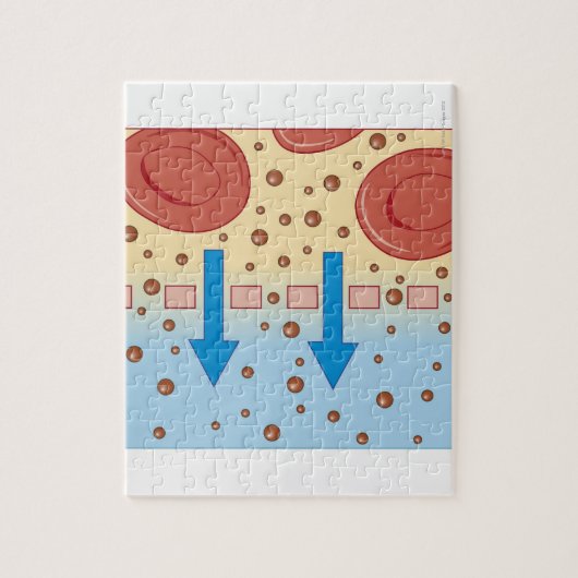 腎透析 ジグソーパズル (縦)