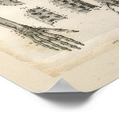 腕の骨の解剖学ヴィンテージプリント ポスター (角)