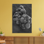 腫瘍の顕微鏡的見解1 キャンバスプリント (インサイチュ (リビング))