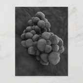 腫瘍の顕微鏡的見解1 ポストカード (正面)