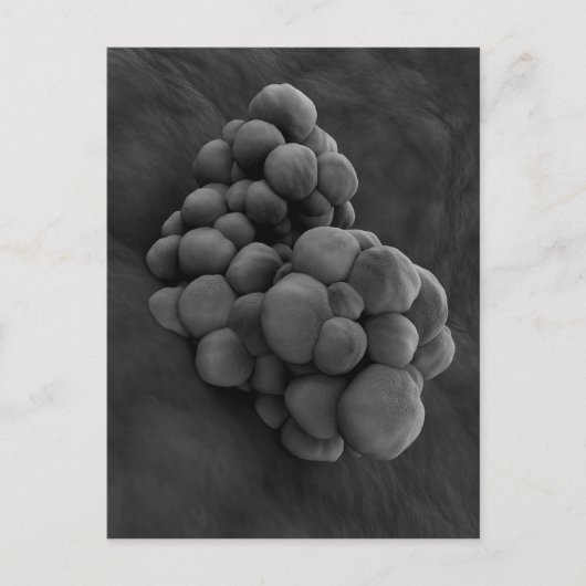 腫瘍の顕微鏡的見解1 ポストカード (正面)