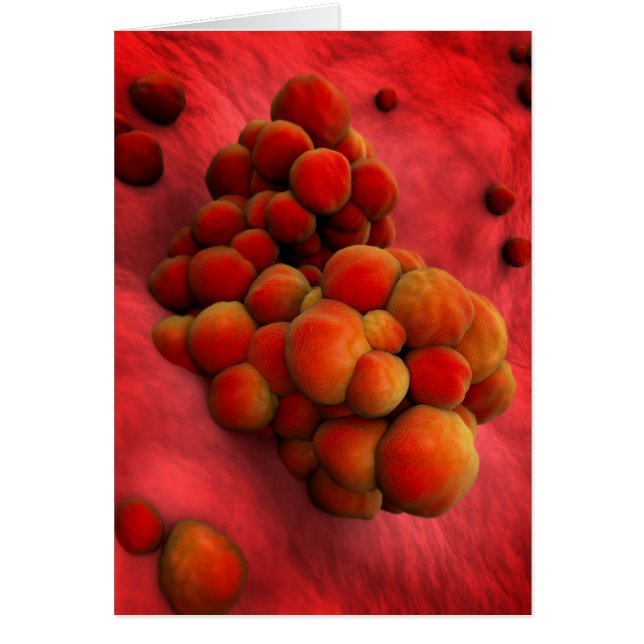 腫瘍の顕微鏡的見解2 (正面)