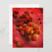 腫瘍の顕微鏡的見解2 ポストカード (正面/裏面)