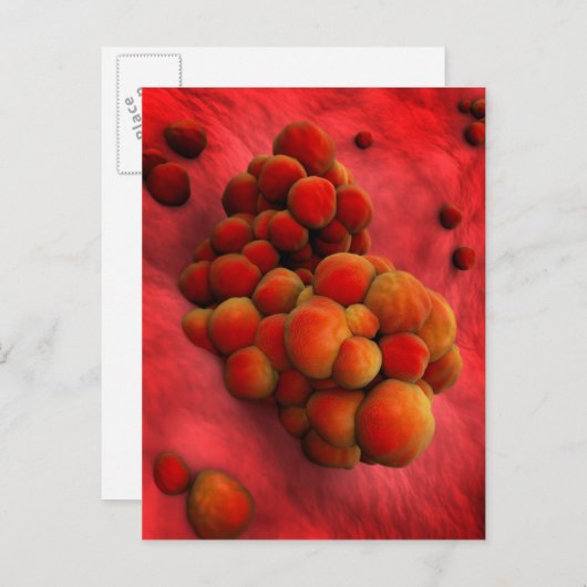 腫瘍の顕微鏡的見解2 ポストカード (正面/裏面)