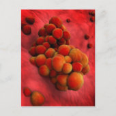 腫瘍の顕微鏡的見解2 ポストカード (正面)