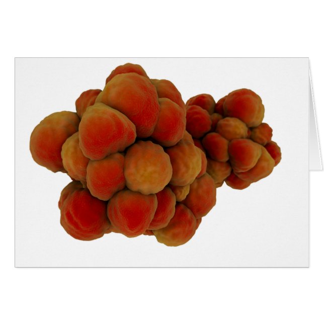 腫瘍の顕微鏡的見解4 (正面横)