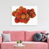 腫瘍の顕微鏡的見解4 キャンバスプリント (インサイチュ (リビング))