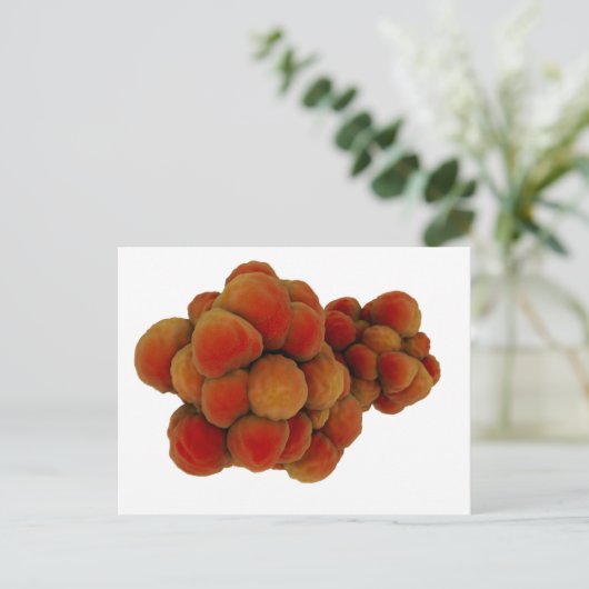 腫瘍の顕微鏡的見解4 ポストカード (スタンド正面)